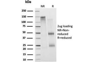 SDS-PAGE Analysis Purified Histone H1 Mouse Monoclonal Antibody (1415-1). (Histone H1 antibody)