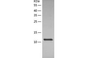 LSM1 Protein (AA 1-133) (His tag)