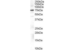 Image no. 1 for anti-Adrenergic, Beta, Receptor Kinase 1 (ADRBK1) (Internal Region) antibody (ABIN374657) (GRK2 antibody  (Internal Region))