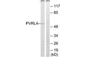 Western blot analysis of extracts from NIH-3T3 cells, using PVRL4 Antibody. (PVRL4 antibody  (AA 312-361))