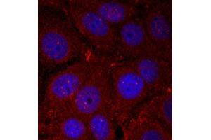 Immunofluorescence staining of methanol-fixed HeLa cells using Phospho-SNCA-Y136 antibody (ABIN2987740). (SNCA antibody  (pTyr136))