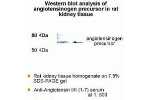 Western Blot analysis of antigiotensinogen precursor in rat kidney tissue. (AGT antibody  (AA 1-7))
