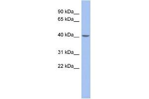 WB Suggested Anti-ZNF302 Antibody Titration:  0. (ZNF302 antibody  (Middle Region))