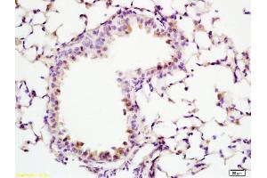 Formalin-fixed and paraffin embedded rat lung labeled with Anti-ADCY10 Polyclonal Antibody, Unconjugated (ABIN751093) at 1:200 followed by conjugation to the secondary antibody and DAB staining (ADCY10 antibody  (AA 1101-1200))