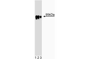 Western blot analysis of HIF-1beta on Jurkat cell lysate. (ARNT antibody  (AA 461-574))