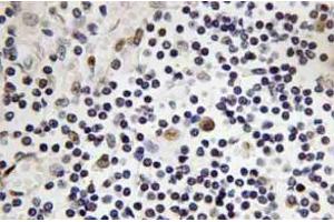 Immunohistochemistry analysis of TAL1 Antibody in paraffin-embedded human lymph node tissue. (TAL1 antibody)