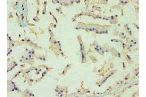 Immunohistochemistry of paraffin-embedded human prostate tissue using ABIN7152459 at dilution of 1:100 (TBL1XR1 antibody  (AA 1-180))
