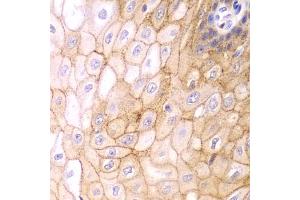 Immunohistochemistry of paraffin-embedded human esophagus using CLDN1 antibody (ABIN5971222) at dilution of 1/100 (40x lens). (Claudin 1 antibody)