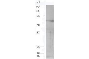 Lane 1: mouse lung probed with Rabbit Anti-STK40 Polyclonal Antibody, Unconjugated (ABIN872896) at 1:300 overnight at 4 °C. (STK40 antibody  (AA 231-330))