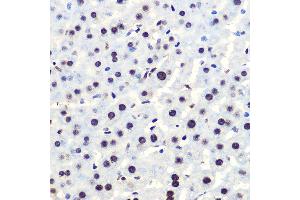 Immunohistochemistry (IHC) image for anti-Nuclear Factor of kappa Light Polypeptide Gene Enhancer in B-Cells Inhibitor, alpha (NFKBIA) (pSer36) antibody (ABIN7268992)