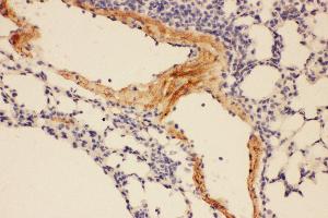 Anti-Adiponectin Picoband antibody,  IHC(P): Mouse Lung Tissue (ADIPOQ antibody  (AA 19-244))