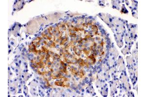 Immunohistochemistry (IHC) image for anti-Hydroxysteroid (11-Beta) Dehydrogenase 2 (HSD11B2) (AA 277-309), (C-Term) antibody (ABIN3043846)