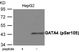 Western blot analysis of extracts from HepG2 cells using GATA4 (Phospho-Ser105) Antibody. (GATA4 antibody  (pSer105))