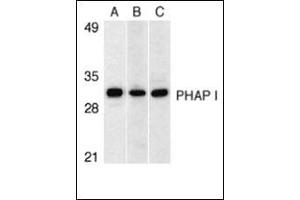 Western blot analysis of PHAP I expression in human Raji cell (A), mouse (B) and rat (C) testis tissue llysates with this product at 1 μg/ml.