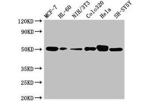 Western Blot Positive WB detected in: MCF-7 whole cell lysate, HL60 whole cell lysate, NIH/3T3 whole cell lysate, Colo320 whole cell lysate, Hela whole cell lysate, SH-SY5Y whole cell lysate All lanes: CALR antibody at 2 μg/mL Secondary Goat polyclonal to rabbit IgG at 1/10000 dilution Predicted band size: 49 kDa Observed band size: 49 kDa (Calreticulin antibody  (AA 18-417))