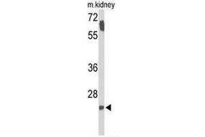 Western blot analysis of SMNDC1 Antibody (N-term) in mouse kidney tissue lysates (35µg/lane). (SMNDC1 antibody  (N-Term))