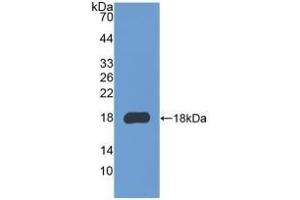 Detection of Recombinant COL3a1, Mouse using Polyclonal Antibody to Collagen Type III Alpha 1 (COL3a1) (COL3A1 antibody  (AA 1224-1371))
