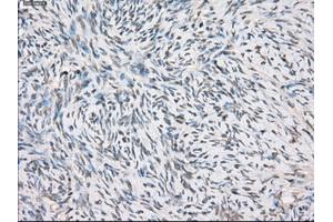 Immunohistochemical staining of paraffin-embedded colon tissue using anti-FCGR2A mouse monoclonal antibody. (FCGR2A antibody)