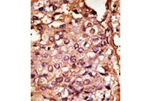 Image no. 1 for anti-Chemokine Binding Protein 2 (CCBP2) (N-Term) antibody (ABIN357385) (CCBP2 antibody  (N-Term))