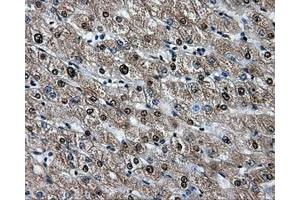 Immunohistochemical staining of paraffin-embedded liver tissue using anti-HSPA1Amouse monoclonal antibody. (HSP70 1A antibody)