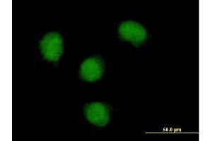 Immunofluorescence of purified MaxPab antibody to NOVA1 on HeLa cell. (NOVA1 antibody  (AA 1-507))
