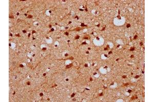 IHC image of ABIN7157277 diluted at 1:300 and staining in paraffin-embedded human brain tissue performed on a Leica BondTM system. (KLHL2 antibody  (AA 1-200))