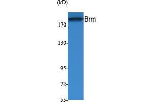 Western Blotting (WB) image for anti-SWI/SNF Related, Matrix Associated, Actin Dependent Regulator of Chromatin, Subfamily A, Member 2 (SMARCA2) (Internal Region) antibody (ABIN3187607) (SMARCA2 antibody  (Internal Region))