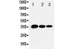 Lane 3: Recombinant Human TBX21 Protein 1.