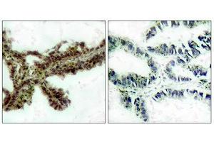 Immunohistochemistry (IHC) image for anti-V-Akt Murine Thymoma Viral Oncogene Homolog 1 (AKT1) (pThr308) antibody (ABIN1847448) (AKT1 antibody  (pThr308))