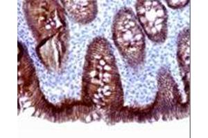 Immunohistochemistry on paraffin embedded sections of small intestine. (E-cadherin antibody)