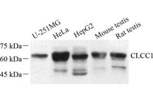 Western blot analysis of CLCC1 (ABIN7073473) at dilution of 1: 500
