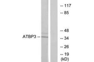 Western blot analysis of extracts from LOVO cells, using ATPBD3 Antibody. (ATPBD3 antibody  (AA 291-340))