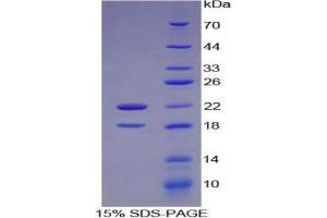 SDS-PAGE analysis of Mouse CSF2Ra Protein.