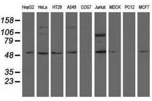 Image no. 2 for anti-5'-Nucleotidase Domain Containing 1 (NT5DC1) antibody (ABIN1499834)