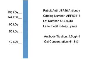 WB Suggested Anti-USP26  Antibody Titration: 0. (USP26 antibody  (Middle Region))
