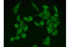 Detection of FUM in Human Hela Cell using Polyclonal Antibody to Fumarase (FUM) (FH antibody  (AA 45-188))