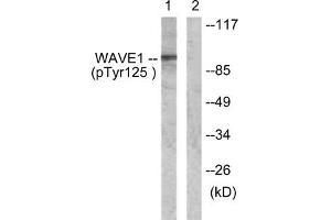 Western blot analysis of extracts from NIH/3T3 cells, treated with Insulin (0. (WASF1 antibody  (pTyr125))