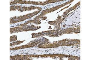 IHC analysis of CA1 using anti-CA1 antibody (ABIN3043766). (CA1 antibody  (AA 9-261))