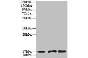 Western blot All lanes: UBE2D1 antibody at 2 μg/mL Lane 1: Mouse thymus tissue Lane 2: NIH/3T3 whole cell lysate Lane 3: Jurkat whole cell lysate Secondary Goat polyclonal to rabbit IgG at 1/10000 dilution Predicted band size: 17 kDa Observed band size: 17 kDa (UBE2D1 antibody  (AA 1-147))