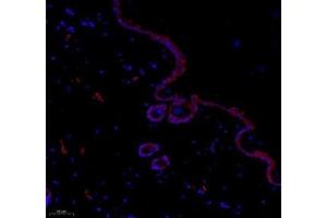 Immunofluorescence of paraffin embedded rat skin using paldadin (ABIN7074976) at dilution of 1: 500 (200x lens) (PALLD antibody)