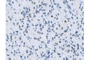 IHC analysis of MTA2 using anti-MTA2 antibody (ABIN7599519). (MTA2 antibody  (AA 1-668))