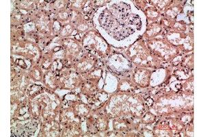Immunohistochemical analysis of paraffin-embedded human-kidney, antibody was diluted at 1:200 (HMMR antibody  (AA 280-340))