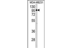 Western blot analysis of BAHD1 Antibody in MDA-MB231 cell line lysates (35ug/lane) (BAHD1 antibody  (C-Term))