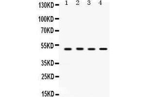 Western Blotting (WB) image for anti-Sulfotransferase Family, Cytosolic, 2B, Member 1 (SULT2B1) (AA 190-218), (Middle Region) antibody (ABIN3043414)