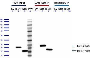 Feimin Immunoprecipitation (IP) followed by Western Blot (WB) analyses.