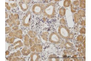 Immunostaining (ISt) image for anti-Protein Kinase, CAMP-Dependent, Regulatory, Type II, alpha (PRKAR2A) (AA 1-105) antibody (ABIN562376)