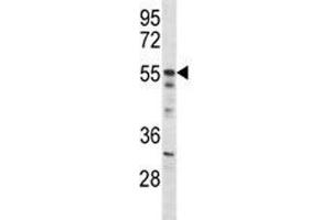 Akt2 antibody western blot analysis in mouse NIH3T3 lysate (AKT2 antibody  (AA 93-122))