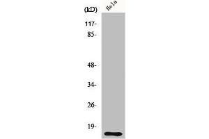 Western Blot analysis of HeLa cells using DOC-1 Polyclonal Antibody
