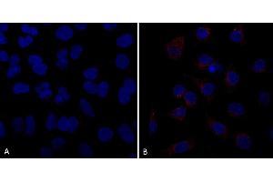 Immunocytochemistry/Immunofluorescence analysis using Mouse Anti-VPS35 Monoclonal Antibody, Clone 10A8 (ABIN6933002). (VPS35 antibody  (PE))