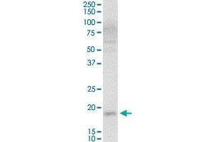 VSTM2L MaxPab rabbit polyclonal antibody. (VSTM2L antibody  (AA 1-204))